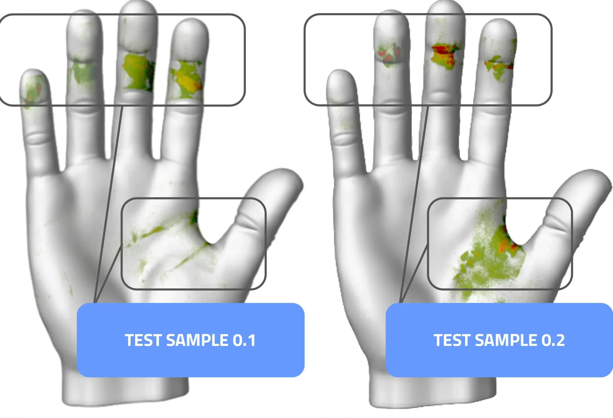Human Factors - Measuring and Visualizing Ergonomic Improvements in Clip Appliers 3 Aesculap Pressure Mapping - Druckverteilung