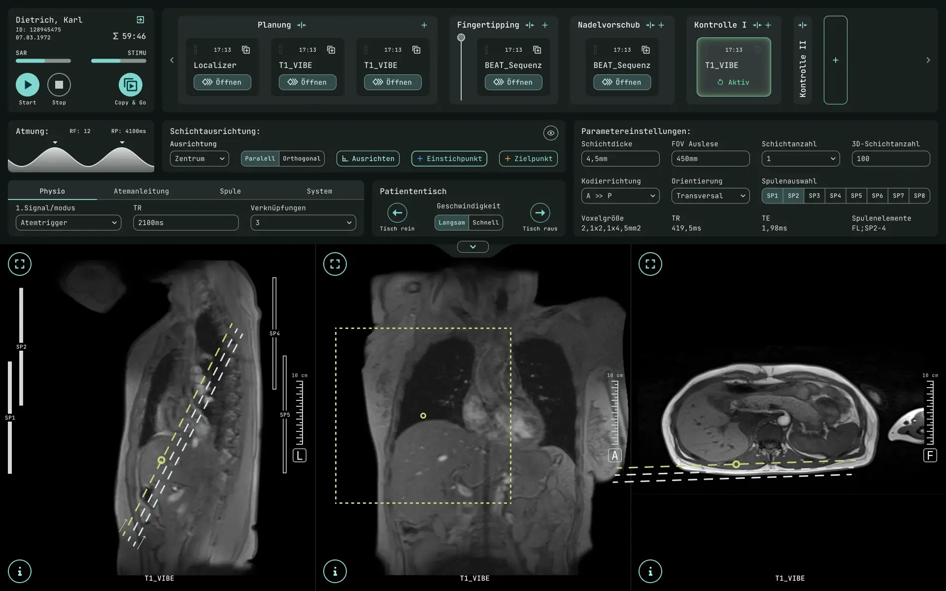 Effektive Workflow Evaluation & Interface Design for iMRI Planning Software 6 UX UI Demonstrator IMRI Software